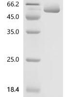 Mouse Talin-2 (Tln2), partial Recombinant Protein, C-10His - BioCrest Sci