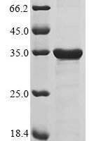 Human Achaete-scute homolog 1 (ASCL1) Recombinant Protein - BioCrest Sci