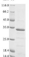 Chicken anemia virus Apoptin (VP3) Recombinant Protein - BioCrest Sci