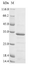 Chicken anemia virus Apoptin (VP3) Recombinant Protein, Chicken anemia virus (isolate Germany Cuxhaven-1) (CAV), E.coli, N-terminal 6xHis-SUMO-tagged, 29.3 kDa, purity >≥ 90% as determined by SDS-PAGE.
