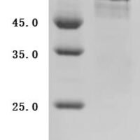 Escherichia coli Colicin-Ia (cia) (626:I→I-QGISSRLAWYQQKPEKAPKSLIYARSPWGYYLDS) Recombinant Protein - BioCrest Sci