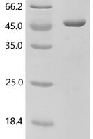 Human Protein-arginine deiminase type-4 (PADI4), partial Recombinant Protein - BioCrest Sci
