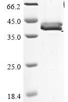 Salmo salar Elastase-1 Recombinant Protein - BioCrest Sci