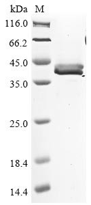 Salmo salar Elastase-1 Recombinant Protein, Salmo salar (Atlantic salmon), E.coli, N-terminal 6xHis-tagged, 31.0 kDa, purity >≥ 85% as determined by SDS-PAGE.