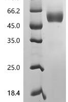 Human Transmembrane and immunoglobulin domain-containing protein 2 (TMIGD2), partial Recombinant Protein, C-hFc1 - BioCrest Sci