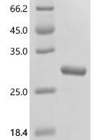 Human Aldehyde oxidase (AOX1), partial Recombinant Protein - BioCrest Sci