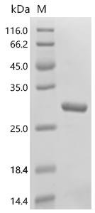 Human Aldehyde oxidase (AOX1), partial Recombinant Protein, Homo sapiens (Human), E.coli, C-terminal 6xHis-tagged, 27.5 kDa, purity >≥ 90% as determined by SDS-PAGE.