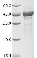 Human S-phase kinase-associated protein 1 (SKP1) Recombinant Protein - BioCrest Sci