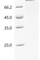 Human Acetylcholinesterase（ACHE) Recombinant Protein - BioCrest Sci