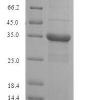 Human Putative 40S ribosomal protein S10-like (RPS10P5) Recombinant Protein - BioCrest Sci