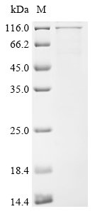 Human Ubiquitin carboxyl-terminal hydrolase 1 (USP1) Recombinant Protein, Homo sapiens (Human), E.coli, N-terminal 6xHis-tagged, 94.3 kDa, purity >≥ 85% as determined by SDS-PAGE.
