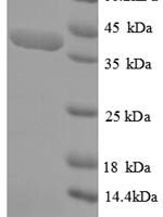 Human Striated muscle preferentially expressed protein kinase (SPEG), partial Recombinant Protein - BioCrest Sci