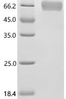 Human Alpha-2-antiplasmin (SERPINF2) Recombinant Protein - BioCrest Sci