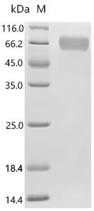 Human Alpha-2-antiplasmin (SERPINF2) Recombinant Protein, Homo sapiens (Human), Mammalian cell, C-terminal 10xHis-tagged, 53.1 kDa, purity >≥ 95% as determined by SDS-PAGE.