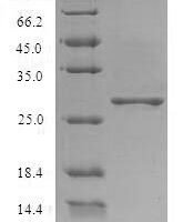 Potato leafroll virus Major capsid protein (ORF3) Recombinant Protein - BioCrest Sci