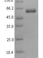 Human Proline-rich protein 11 (PRR11) Recombinant Protein - BioCrest Sci
