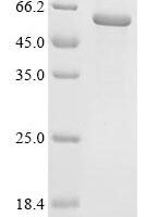 Human Tubulin alpha-1A chain (TUBA1A) Recombinant Protein - BioCrest Sci