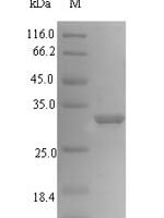 Actinidia deliciosa Bet v 1 related allergen (ypr-10) Recombinant Protein - BioCrest Sci