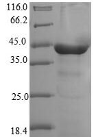 Human Cytoplasmic dynein 2 light intermediate chain 1 (DYNC2LI1) Recombinant Protein, N-10His/C-Myc - BioCrest Sci