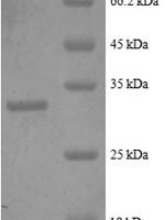 Human Metallothionein-2 (MT2A), partial Recombinant Protein, N-GST - BioCrest Sci