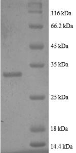 Human Metallothionein-2 (MT2A), partial Recombinant Protein, N-GST, Homo sapiens (Human), E.coli, N-terminal GST-tagged, 32.9 kDa, purity >≥ 90% as determined by SDS-PAGE.