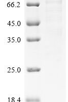 Pig Glutamate carboxypeptidase 2 (FOLH1), partial,Biotinylated Recombinant Protein - BioCrest Sci