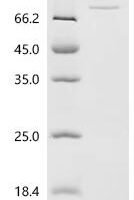 Human Sepiapterin reductase (SPR), Biotinylated Recombinant Protein - BioCrest Sci