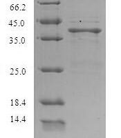 Lithobates catesbeiana Saxiphilin, partial Recombinant Protein, N-His - BioCrest Sci