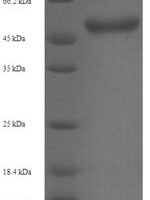 Staphylococcus aureus Malonyl CoA-acyl carrier protein transacylase (fabD) Recombinant Protein - BioCrest Sci