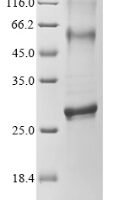 Human Cyclin-dependent kinase 5 activator 1 (CDK5R1), partial Recombinant Protein - BioCrest Sci