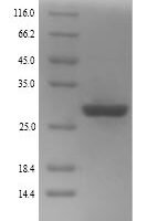 Human Zinc finger protein GLI2 (GLI2), partial Recombinant Protein, N-His - BioCrest Sci