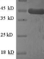 Human Homer protein homolog 1 (HOMER1) Recombinant Protein - BioCrest Sci
