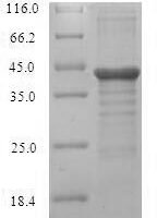 Human Protein unc-119 homolog A (UNC119) Recombinant Protein - BioCrest Sci