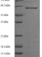 Human Serine/threonine-protein kinase 25 (STK25) Recombinant Protein - BioCrest Sci