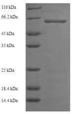 Human Serine/threonine-protein kinase 25 (STK25) Recombinant Protein, Homo sapiens (Human), E.coli, N-terminal 6xHis-SUMO-tagged, 64.1 kDa, purity >≥ 90% as determined by SDS-PAGE.