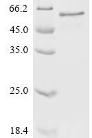 Human Mothers against decapentaplegic homolog 3 (SMAD3) Recombinant Protein, N-10His, aa 1–425, E.coli - BioCrest Sci