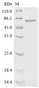 Human Mothers against decapentaplegic homolog 3 (SMAD3) Recombinant Protein, N-10His, aa 1–425, E.coli, Homo sapiens (Human), E.coli, N-terminal 10xHis-tagged, 51.7 kDa, purity >≥ 90% as determined by SDS-PAGE.