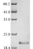 Human Glial fibrillary acidic protein (GFAP), partial Recombinant Protein - BioCrest Sci