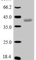 Pig Epididymal secretory glutathione peroxidase (GPX5) Recombinant Protein - BioCrest Sci