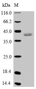 Pig Epididymal secretory glutathione peroxidase (GPX5) Recombinant Protein, Sus scrofa (Pig), E.coli, N-terminal 10xHis-SUMO-tagged and C-terminal Myc-tagged, 42.6 kDa, purity >≥ 90% as determined by SDS-PAGE.