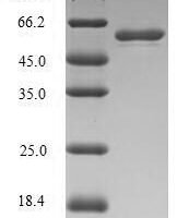 Human Stromelysin-1 (MMP3), partial Recombinant Protein - BioCrest Sci