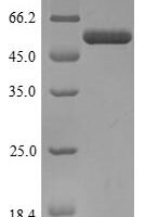 Human Collagen alpha-1 (XI) chain (COL11A1), partial Recombinant Protein, N-GST - BioCrest Sci