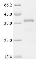 Human Metallothionein-1A (MT1A), partial Recombinant Protein, C-GST - BioCrest Sci