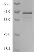 Human GTP-binding protein GEM (GEM) Recombinant Protein, C-His - BioCrest Sci