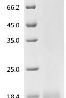 Mouse Transcription factor MafF (Maff) Recombinant Protein, C-His, aa 1–156, Yeast - BioCrest Sci