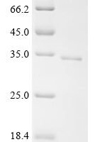 Human Regulator of G-protein signaling 16 (RGS16) Recombinant Protein, N-10His/C-Myc - BioCrest Sci