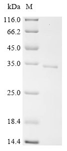 Human Regulator of G-protein signaling 16 (RGS16) Recombinant Protein, N-10His/C-Myc, Homo sapiens (Human), E.coli, N-terminal 10xHis-tagged and C-terminal Myc-tagged, 30.2 kDa, purity >≥ 90% as determined by SDS-PAGE.