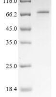 Mouse Galactocerebrosidase (Galc) Recombinant Protein - BioCrest Sci