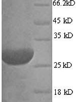 Aspergillus fumigatus Hydrophobin (rodA) Recombinant Protein, N-His - BioCrest Sci