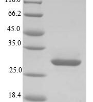 Heron hepatitis B virus Protein P (P), partial Recombinant Protein - BioCrest Sci
